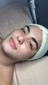 4 Your Skin Esthetic - Foto 2