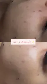 4 Your Skin Esthetic - Foto 5